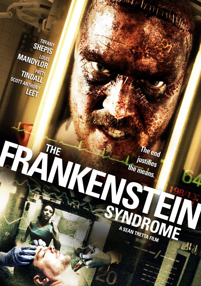 Синдром Франкенштейна (2010) постер